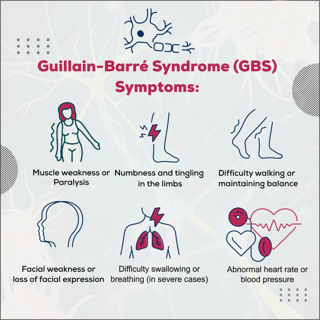 Understanding Guillain Barr Syndrome Causes Effects And Treatment Understanding Guillain Barr Syndrome Causes Effects And Treatment